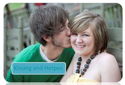 Kissing is a major cause of herpes